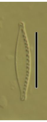 Nitzschia lacuum