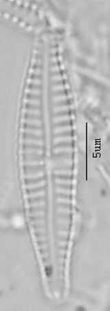 Gompohcymbellopsis ancyli