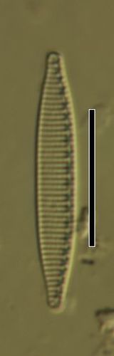 Nitzschia frustulum