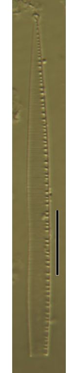Nitzschia linearis