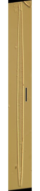 Synedra ulna