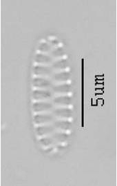 Fragilaria pinnata