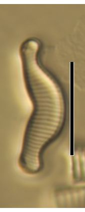 Eunotia exigua