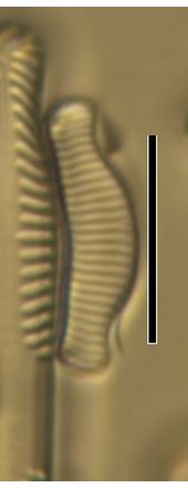 Eunotia exigua