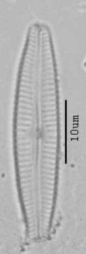 Cymbopleura subaequalis