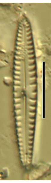 Gomphonema pumilum