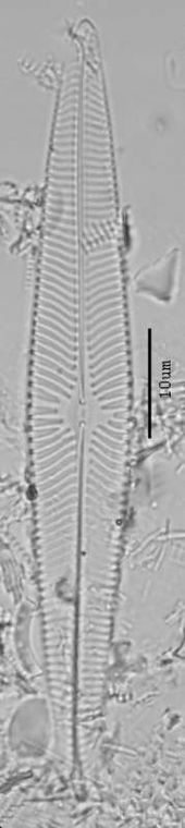 Navicula radiosa