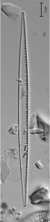 Nitzschia linearis