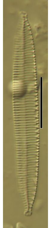 Nitzschia hungarica