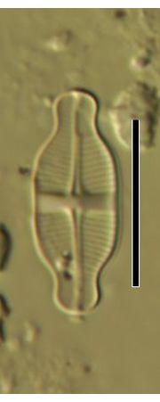 Achnanthidium exiguum