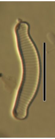 Eunotia exigua