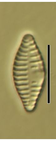 Fragilaria capucina