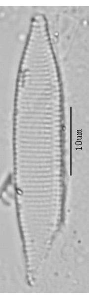 Nitzschia angustata