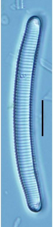 Eunotia glacialis