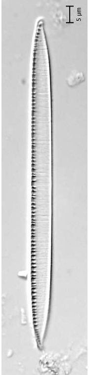 Nitzschia linearis