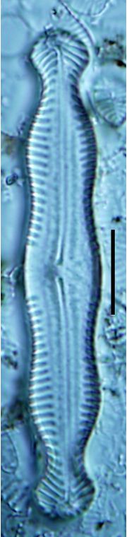 Pinnularia nodosa