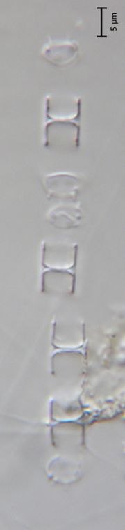 Skeletonema potamos