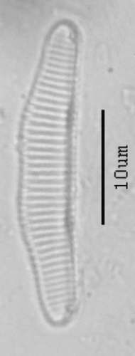 Eunotia implicata