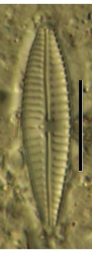 Gomphonema parvulum