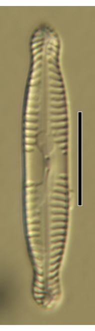 Pinnularia subcapitata