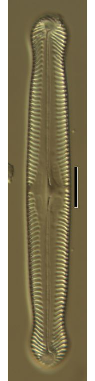Pinnularia gibba
