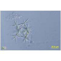 Actinastrum aciculare