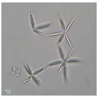 Actinastrum cf. fluviatile