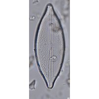 Anomoeoneis sphaerophora