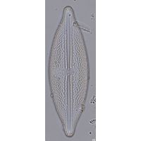 Anomoeoneis sphaerophora
