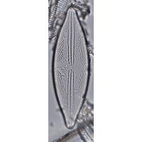 Anomoeoneis sphaerophora