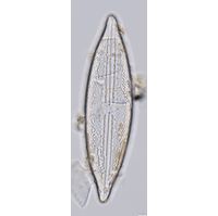 Anomoeoneis sphaerophora