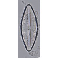 Anomoeoneis sphaerophora