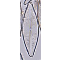 Anomoeoneis sphaerophora
