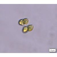 Tetrabaena socialis