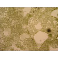 Tetraspora cylindrica