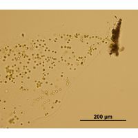 Tetraspora gelatinosa