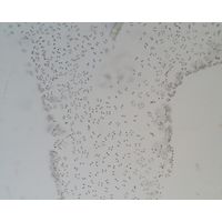 Tetraspora gelatinosa