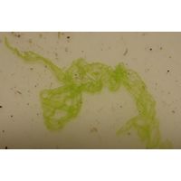 Tetraspora gelatinosa