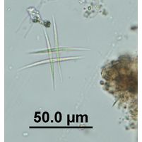 Ankistrodesmus fusiformis