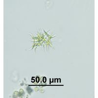 Ankistrodesmus gracilis