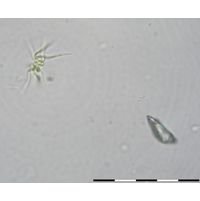 Ankistrodesmus spiralis