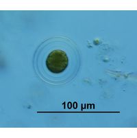 Asterococcus superbus