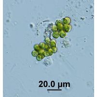 Botryosphaerella sudetica