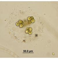 Botryosphaerella sudetica