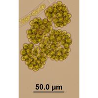 Botryosphaerella sudetica