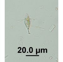 Characium cf. rostratum