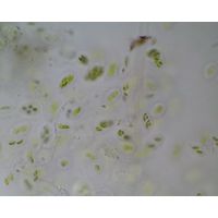 Coccomyxa sp.