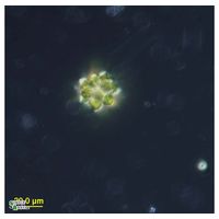 Coelastrum astroideum