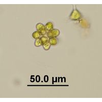 Coelastrum astroideum