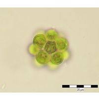 Coelastrum microporum